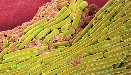 This scanning electron micrograph shows Clostridium difficile bacterial cells as they are dividing.